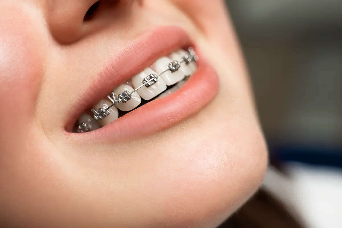 Opportunity in Orthodontic Treatment