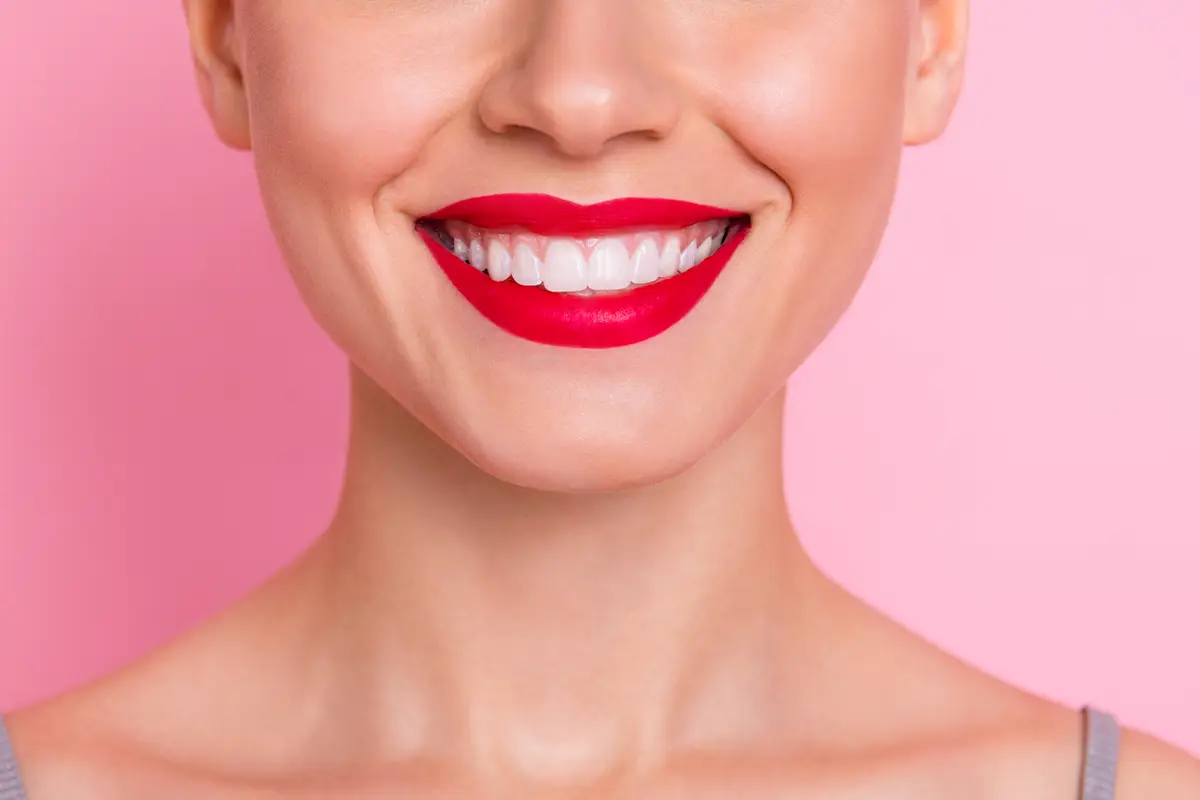 Hollywood Smile: Design Your Smile