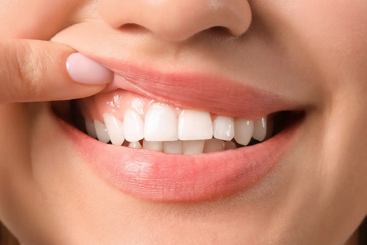 Receding Gums: Causes, Symptoms, and Treatment